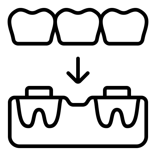 التركيبات